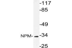 Western blot (WB) analysis of NPM antibody in extracts from HeLa cells. (NPM1 抗体)