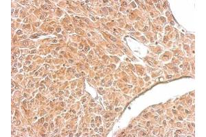 IHC-P Image Amphiphysin antibody [N1N2], N-term detects AMPH protein at cytosol on U87 xenograft by immunohistochemical analysis. (Amphiphysin 抗体  (N-Term))