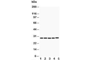 Western blot testing of CD40L antibody and Lane 1:  MCF-7;  2: HeLa;  3: Jurkat;  4: HMY2;  5: COLO320;  Predicted size: 29KD;  Observed size: 29KD (CD40 Ligand 抗体  (N-Term))