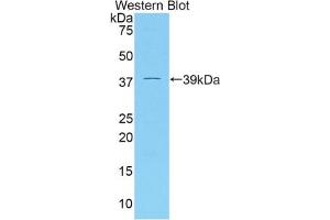 Western blot analysis of the recombinant protein. (DKK4 抗体  (AA 37-141))