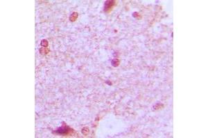 Immunohistochemical analysis of ZHX2 staining in human brain formalin fixed paraffin embedded tissue section. (ZHX2 抗体  (C-Term))