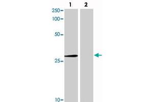 Western blot analysis in Lane 1: 293 cells transfected with Abcc10 and Lane 2: 293 cells transfected withoud Abcc10 with Abcc10 monoclonal antibody, clone C1. (ABCC10 抗体  (AA 890-894))