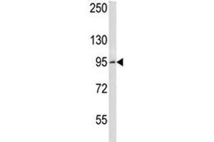 BCL6 antibody western blot analysis in HeLa lysate.