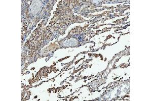 IHC analysis of ACE using anti-ACE antibody (ABIN3043777). (Angiotensin I Converting Enzyme 1 抗体  (AA 651-864))
