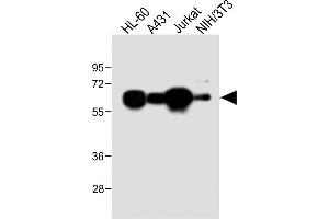 All lanes : Anti-METTL14 Antibody (N-Term) at 1:2000 dilution Lane 1: HL-60 whole cell lysate Lane 2: A431 whole cell lysate Lane 3: Jurkat whole cell lysate Lane 4: NIH/3T3 whole cell lysate Lysates/proteins at 20 μg per lane. (METTL14 抗体  (AA 2-36))