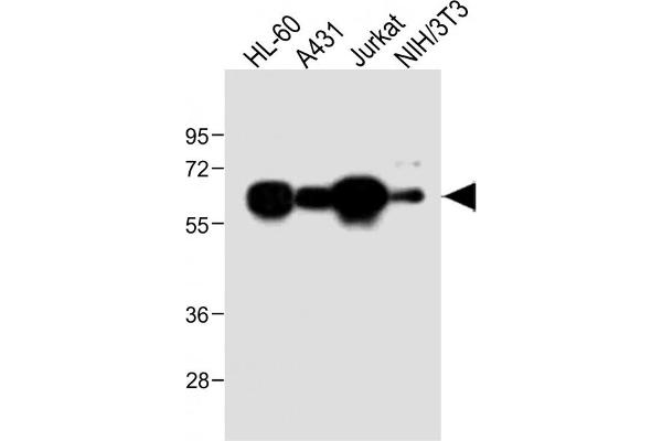 METTL14 anticorps  (AA 2-36)