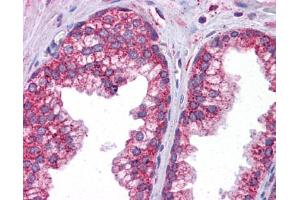 Immunohistochemistry (IHC) image for anti-Signal Transducer and Activator of Transcription 6, Interleukin-4 Induced (STAT6) (C-Term) antibody (ABIN486817) (STAT6 抗体  (C-Term))