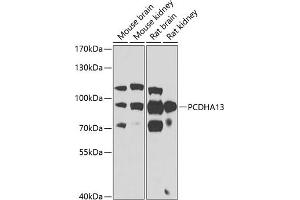 Western blot analysis of extracts of various cell lines, using PCDH antibody (ABIN6129639, ABIN6145299, ABIN6145300 and ABIN6223365) at 1:1000 dilution. (PCDHa13 抗体  (AA 300-360))