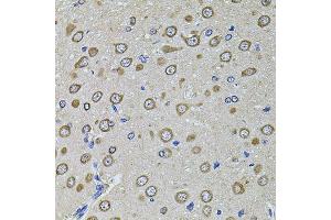 Immunohistochemistry of paraffin-embedded rat brain using EIF4A2 antibody (ABIN2736687) at dilution of 1:100 (40x lens). (EIF4A2 抗体)