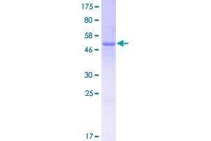 TPSD1 Protein (AA 1-242) (GST tag)