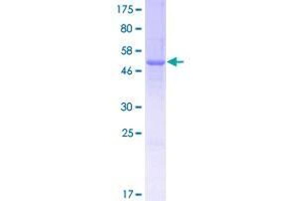 TPSD1 Protein (AA 1-242) (GST tag)