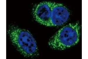 Confocal immunofluorescent analysis of TGFB2 antibody with A549 cells followed by Alexa Fluor 488-conjugated goat anti-rabbit lgG (green).