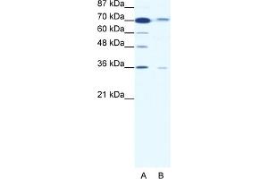 WB Suggested Anti-SMAD4 Antibody Titration:  1. (SMAD4 抗体  (Middle Region))