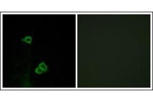 Immunofluorescence analysis of COS7 cells, using CXCR7 Antibody. (CXCR7 抗体  (C-Term))