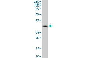 DECR2 monoclonal antibody (M03), clone 4A7. (DECR2 抗体  (AA 49-109))