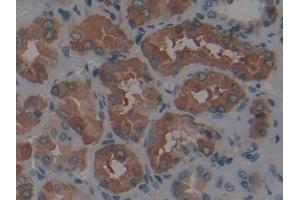 Immunohistochemistry (IHC) image for anti-Ferritin, Heavy Polypeptide 1 (FTH1) (AA 1-183) antibody (ABIN7435313)