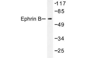Image no. 1 for anti-Ephrin B1 (EFNB1) antibody (ABIN271886) (Ephrin B1 抗体)