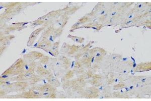 Immunohistochemistry of paraffin-embedded Mouse heart using FGFR2 Polyclonal Antibody at dilution of 1:100 (40x lens). (FGFR2 抗体)