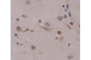 IHC-P analysis of Human Tissue, with DAB staining. (E2F2 抗体  (AA 129-429))