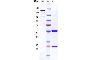 Anti-CXCL8 / IL-8 Reference Antibody (ABX-IL8) on SDS-PAGE under reducing (R) condition.