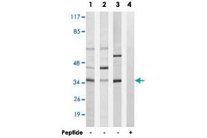 Western blot analysis of extracts from A-549 cells (Lane 1), LoVo cells (Lane 2) and K-562 cells (Lane 3 and lane 4), using CA5A polyclonal antibody . (CA5A 抗体)