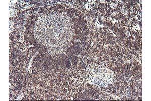 Immunohistochemical staining of paraffin-embedded Human tonsil using anti-PDLIM2 mouse monoclonal antibody. (PDLIM2 抗体)