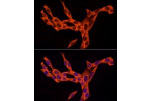 Immunofluorescence analysis of NIH/3T3 cells using RA Rabbit mAb (ABIN7269814) at dilution of 1:100 (40x lens). (RAB8A 抗体)