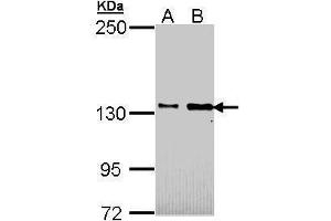 WB Image Sample (30 ug of whole cell lysate) A: H1299 B: Hela 5% SDS PAGE antibody diluted at 1:1000