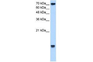 WB Suggested Anti-UBE2N Antibody Titration:  2. (UBE2N 抗体  (Middle Region))