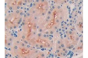 Immunohistochemistry (IHC) image for anti-Collagen, Type III, alpha 1 (COL3A1) (AA 1171-1435) antibody (ABIN7435409)