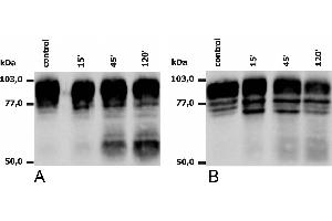 Western blotting analysis of PMA-activated neutrophils (A) and monocytes (B), using anti-human CD18 (MEM-148). (Integrin beta 2 抗体)