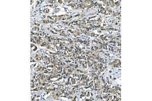 IHC analysis of ASS1 using anti-ASS1 antibody (ABIN7601191). (ASS1 抗体  (AA 3-365))