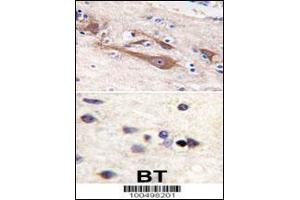 Formalin-fixed and paraffin-embedded human brain tissue reacted with VILIP1 antibody (C-term ), which was peroxidase-conjugated to the secondary antibody, followed by DAB staining. (VSNL1 抗体  (C-Term))