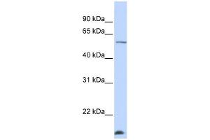 WB Suggested Anti-WDR40A Antibody Titration:  0. (DCAF12 抗体  (N-Term))