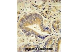 Immunohistochemistry (Paraffin-embedded Sections) (IHC (p)) image for anti-Iduronidase, alpha-L- (IDUA) (AA 236-264) antibody (ABIN651536)