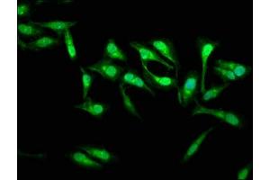 Immunofluorescence staining of Hela cells with ABIN7165980 at 1:133, counter-stained with DAPI. (SSH3 抗体  (AA 480-659))