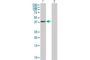 Western Blot analysis of UCKL1 expression in transfected 293T cell line by UCKL1 MaxPab polyclonal antibody. (UCKL1 抗体  (AA 1-419))
