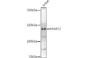 Western blot analysis of extracts of Jurkat cells, using (ABIN3017384, ABIN3017385, ABIN3017386 and ABIN6220063) at 1:1000 dilution. (NFAT1 抗体)