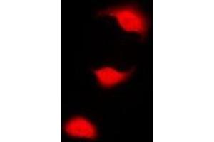Immunofluorescent analysis of CHK1 (pS301) staining in HeLa cells. (CHEK1 抗体  (pSer301))