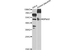 Western blot analysis of extracts of various cell lines, using DFNA5 Antibody. (DFNA5 抗体)