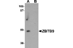 Western Blotting (WB) image for anti-Zinc Finger and BTB Domain Containing 9 (ZBTB9) (C-Term) antibody (ABIN1030815) (ZBTB9 抗体  (C-Term))