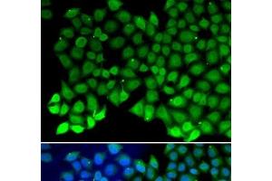 Immunofluorescence analysis of MCF-7 cells using RPA1 Polyclonal Antibody (RPA1 抗体)