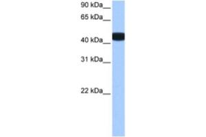 Western Blotting (WB) image for anti-Branched Chain Ketoacid Dehydrogenase Kinase (BCKDK) antibody (ABIN2463496) (BCKDK 抗体)