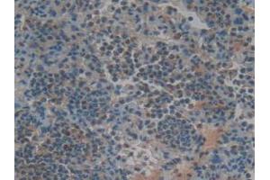 IHC-P analysis of Rat Lung Tissue, with DAB staining. (TNFRSF11A 抗体  (AA 31-214))