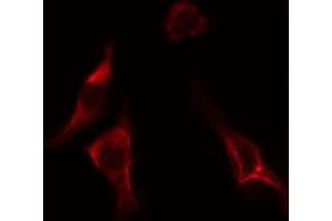 ABIN6274551 staining LOVO cells by IF/ICC. (ERGIC3 抗体  (C-Term))