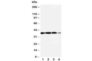 Western Blotting (WB) image for anti-Arginase, Type II (ARG2) (N-Term) antibody (ABIN3030019)