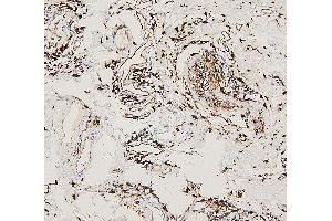 IHC analysis of HLA-DRA using anti-HLA-DRA antibody (ABIN7600948). (HLA-DRA 抗体  (AA 26-254))