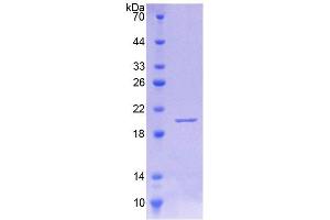 SDS-PAGE (SDS) image for Interleukin 18 Binding Protein (IL18BP) (AA 29-193) protein (His tag) (ABIN1170739) (IL18BP Protein (AA 29-193) (His tag))