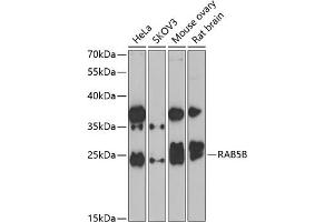 Western blot analysis of extracts of various cell lines, using RB antibody (ABIN6128601, ABIN6146597, ABIN6146598 and ABIN6223325) at 1:1000 dilution. (RAB5B 抗体  (AA 1-215))