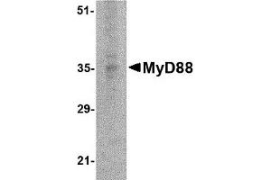 Western Blotting (WB) image for anti-Myeloid Differentiation Primary Response Gene (88) (MYD88) antibody (ABIN1031779) (MYD88 抗体)